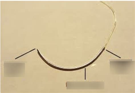 suture patterns  id diagram quizlet