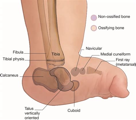 Parts Of A Talus