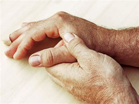 Collagen Vascular Disease: Causes, Symptoms & Treatments