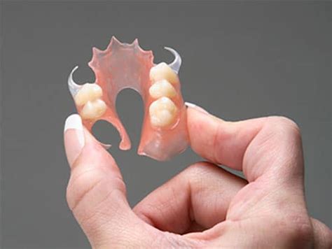 Flexible Dentures | sMiles Better Manchester