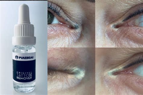 CРЕДСТВО ДЛЯ УДАЛЕНИЯ ТАТУИРОВОК PUREBEAU TATTOO REMOVER Производится ...