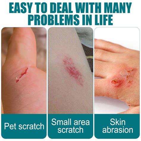 Buy Liquid Wound Dressing-Skin Crack Care, Liquid Bandage, Great for