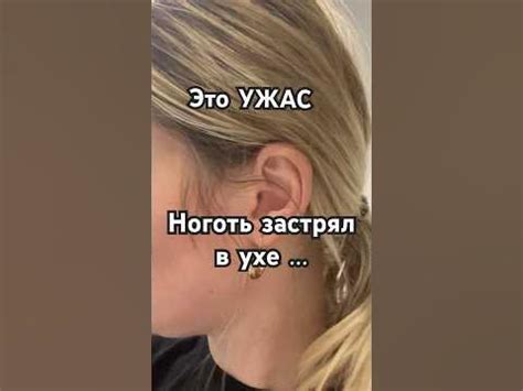 Нарощенный ноготь застрял в ухе 😳 Это страшно 😕 #надиктв #чп #форсмажор ...