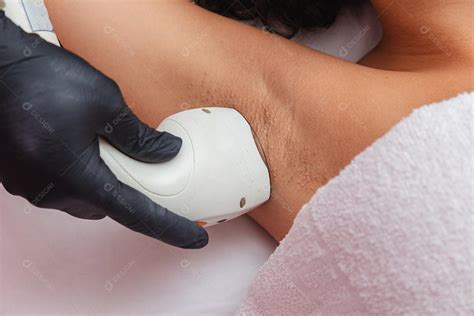 Clareamento A Laser Nas Axilas - Mulher morena brasileira realizando depilação a laser nas axilas ...