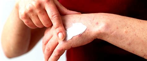 pomada vitamina ad el aliado perfecto  el cuidado de tu piel mi