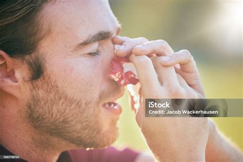 Nose Bleed Man And Injury Closeup On Sport Field With Emergency ...