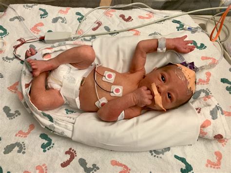 A beginner guide to understanding nec mapping 1