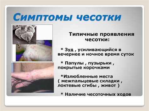 Чесотка. Возбудители чесотки. Симптомы и лечение. Профилактика чесотки ...