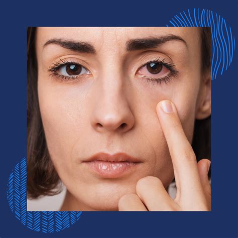 Dry Eye Treatment in Hampstead, NC | Atlantic Eye Associates