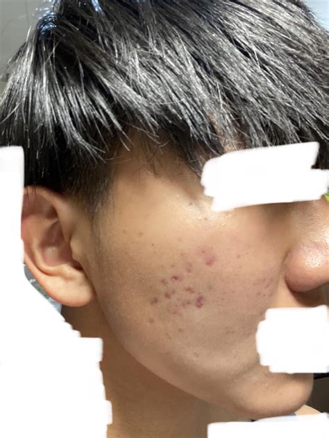 Anyone know how to get rid this? Right side of face is fine as it