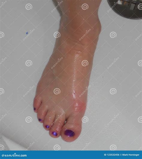 Pretty Toes Feet Painted Purple Nailpolish Stock Photo - Image of