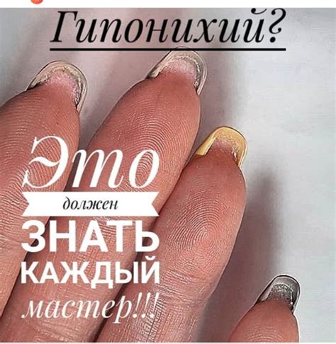 ⚡ Гипонихий! Что нам нужно о нем знать? Говоря простыми словами, иногда ...