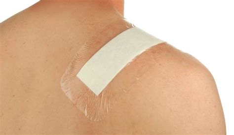 apply occlusive dressing step  step guide  gunshot wound