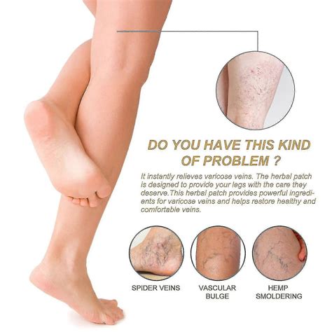 South Moon Vein Care Patch Vein Massage Relieve Leg Soreness and