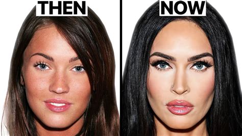 Megan Fox SHOCKING Plastic Surgery Transformation - Cyber Clinic