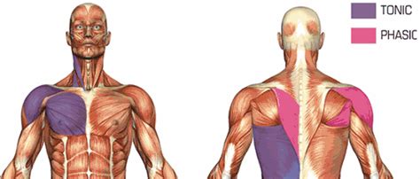 Posture Brace - Posture Correction Bracing