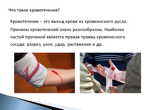 Кровотечения. Виды кровотечений, их признаки - презентация онлайн