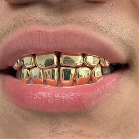 14k Gold Grillz - Gold Teeth Master