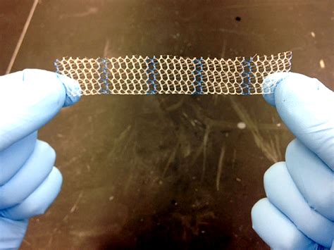 Scientists develop alternative material for mesh implants - The Sunday Post