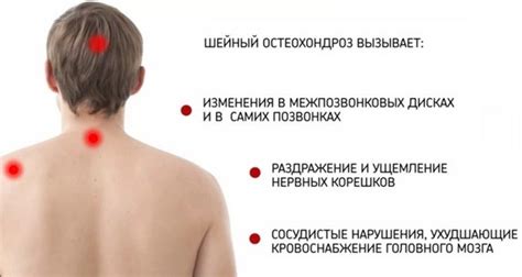 Мази от боли в шее и плече: разогревающая, обезболивающая, гель от ...