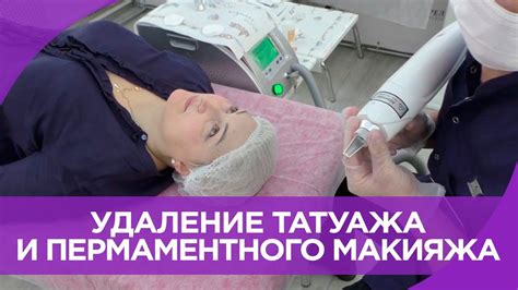 Удаление ТАТУАЖА и ПЕРМАНЕНТНОГО МАКИЯЖА ЛАЗЕРОМ и РЕМУВЕРОМ. Обучающее ...