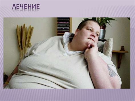 Синдром Прадера- Вилли - online presentation