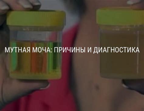 Причины мутной мочи у женщин, мужчин, детей, беременных, мутная моча с ...