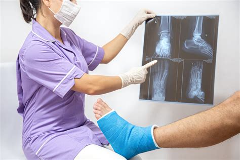 Stress Fracture Treatment for Fast Recovery | Prospero Medical