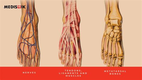 Why Does the Top of My Foot Hurt All of a Sudden? Relief – MEDISTIK