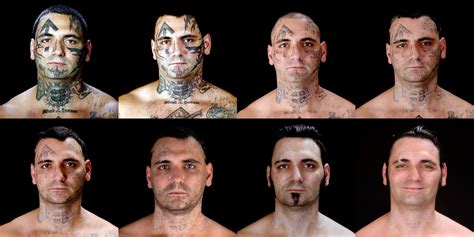 how much to get a tattoo removed