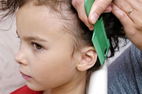 Pharmamum Cases - Head Lice - Pharmamum