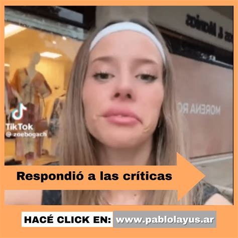 Zoe Bogach enfrentó el repudio en redes por sus retoques estéticos