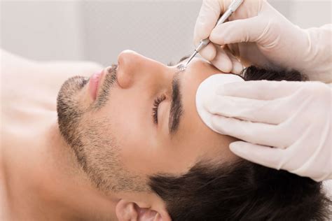 Forget Everything You Know About Unbelievable Blackhead Removal 2024! Image 1