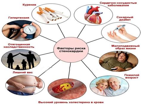 Сестринский уход при стенокардии - презентация онлайн