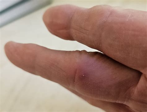 life   splinters joey havens