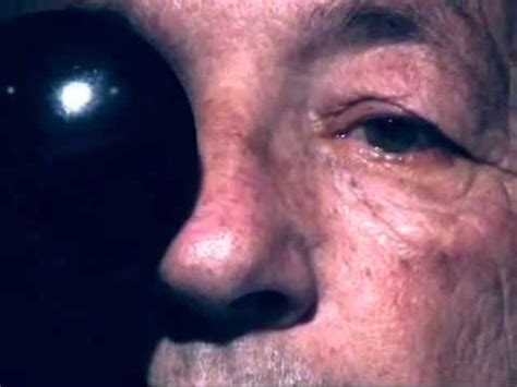 Fourth (4th) Cranial Nerve Palsy - YouTube