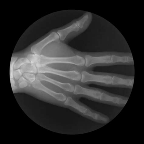 GROBLJANSKI KRUG: The Man with the X-Ray Eyes
