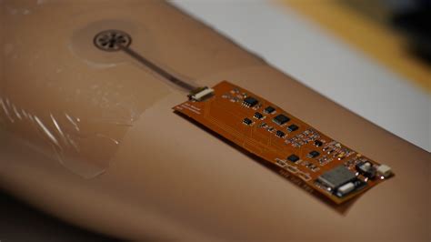 Singapore tests out 'smart bandage' for remote recovery | Reuters