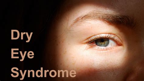 Dry Eye Syndrome: Effective Treatments and Prevention Tips