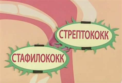 Золотистый стрептококк (стрептококк ауреус): бывает ли в горле или зеве ...
