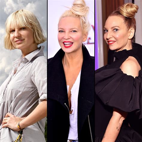 Sia Plastic Surgery Before and After Transformation Photos | Life & Style