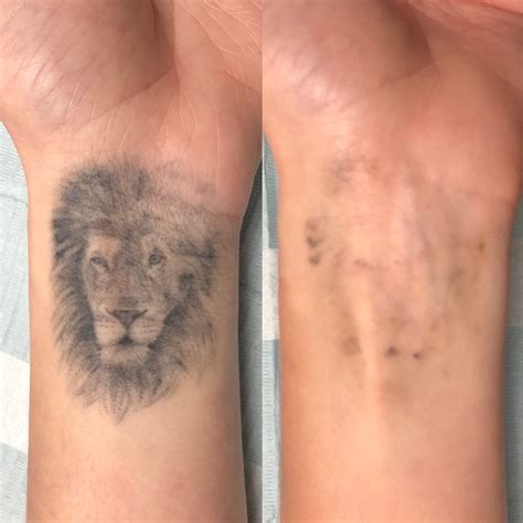 Wrecking Balm Tattoo Removal: Does It Work? - Hunter Games Magazine