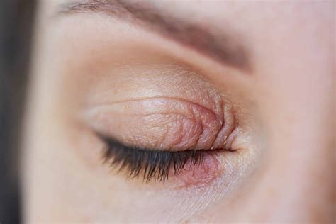 Best Moisturizer for Dry Eyelids - My Skincare Routine