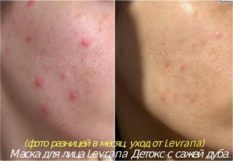 Маска для лица Levrana Детокс с сажей дуба - «Потрясающая динамика ...