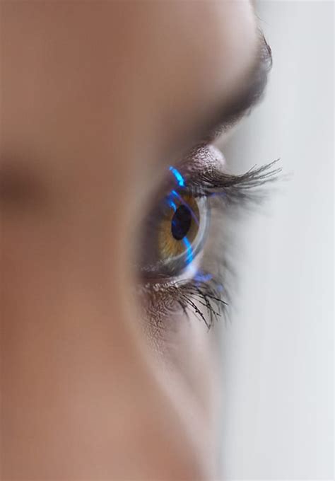 laser eye surgery consultation northwest family eyecare san antonio