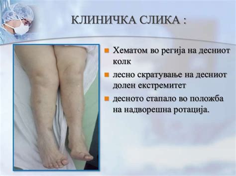 Fractura colli femoris