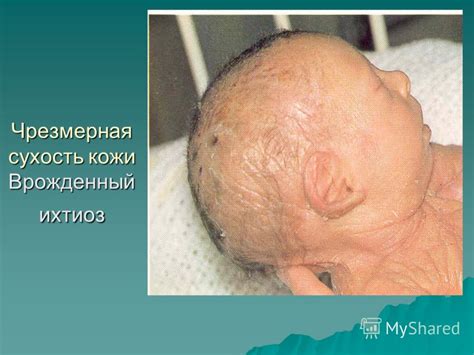 Презентация на тему: "Доц. Горишная И.Л. Морфологические и ...