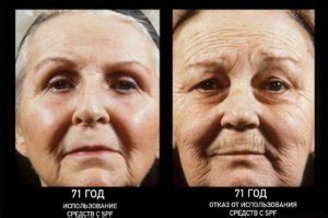 Ликбез по солнцу: теория фотостарения, SPF и рак кожи. — Косметология ...