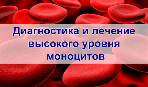 Диагностика и лечение высокого уровня моноцитов