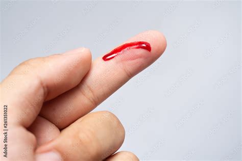 Bleeding blood from the cut finger wound. Injured finger with bleeding ...